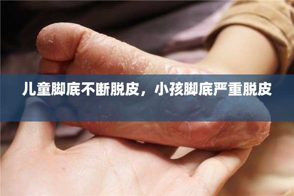儿童脚底不断脱皮，小孩脚底严重脱皮 
