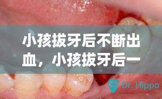 小孩拔牙后不断出血,小孩拔牙后一直流血怎么处理